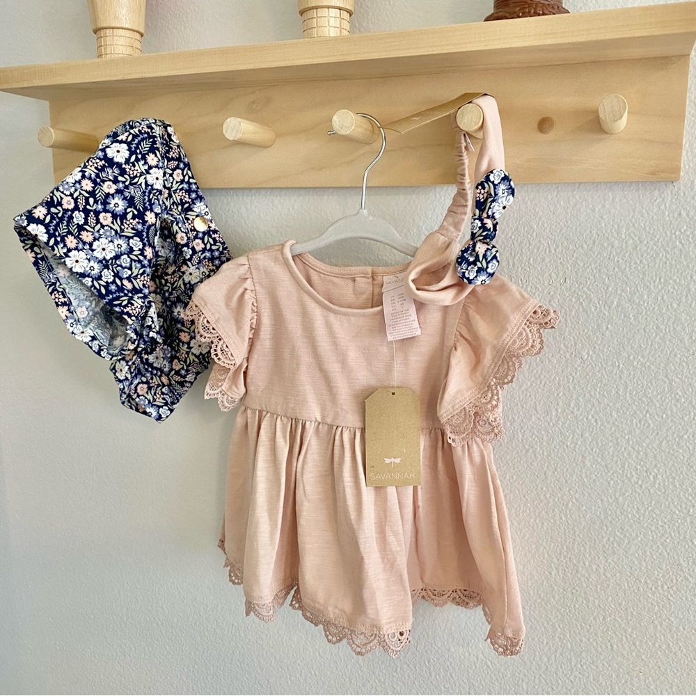 Lace Trim Set